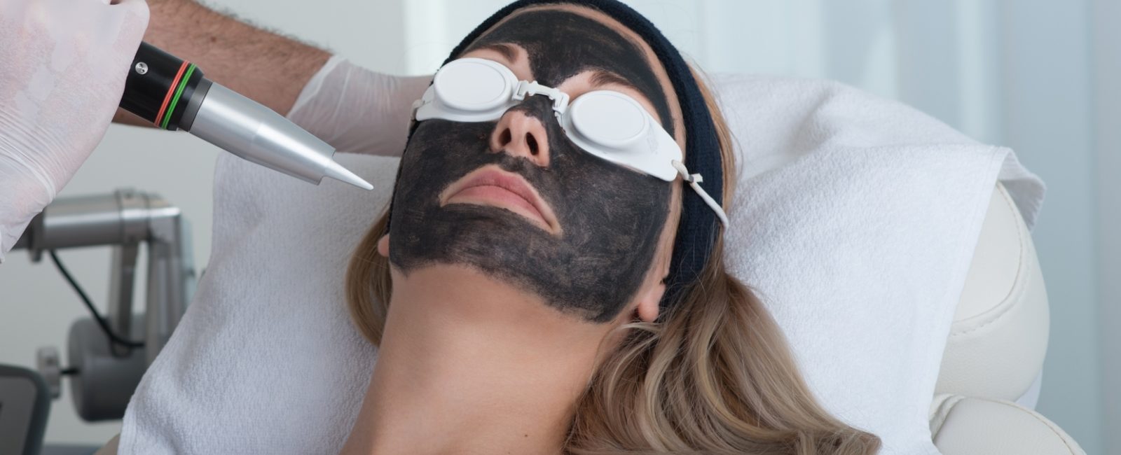 פילינג קרבון בלייזר