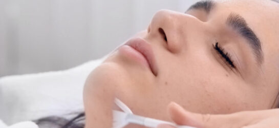 טיפול בצלקות אקנה: אילו שיטות באמת עוזרות? tca peeling Aknenarben behandeln dermacare wien1 טיפול בצלקות אקנה: אילו שיטות באמת עוזרות?