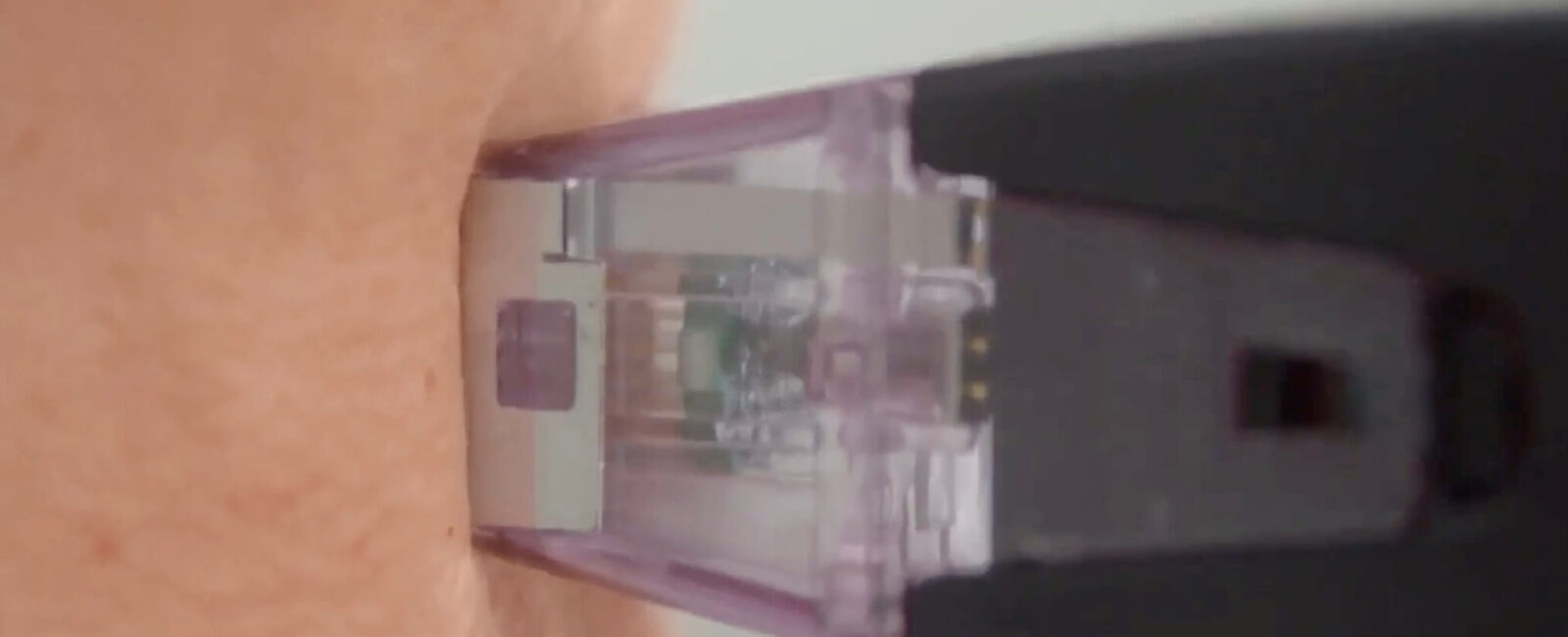RF MAX: הדור המתקדם למיצוק עור לעומת מורפיאוס 8