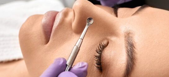 הסרת קומודונים ללא לחיצה – האם זה אפשרי? mitesser entfernen gesicht frau was hilft gegen mitesser1 הסרת קומודונים ללא לחיצה – האם זה אפשרי?