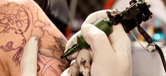 קעקוע על צלקות? כל מה שאתם צריכים לדעת