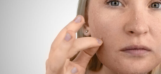 עור יבש בחורף: הסבר מהדרמטולוגית