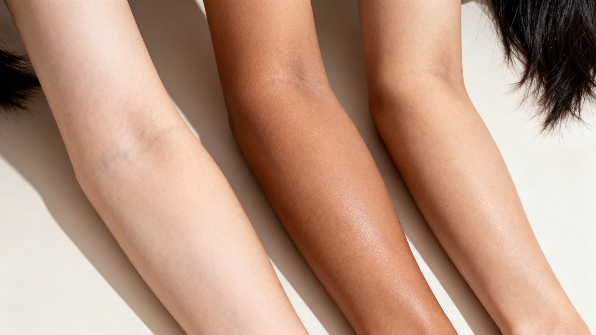 שלוש זרועות עם גווני עור שונים, המייצגות מגוון רחב של סוגי עור.